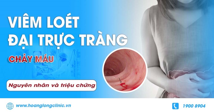 Viêm loét đại trực tràng chảy máu nguyên nhân và triệu chứng