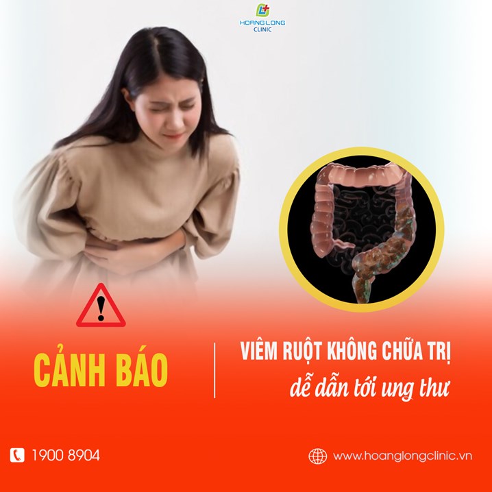 Viêm ruột không chữa trị dễ dẫn tới ung thư