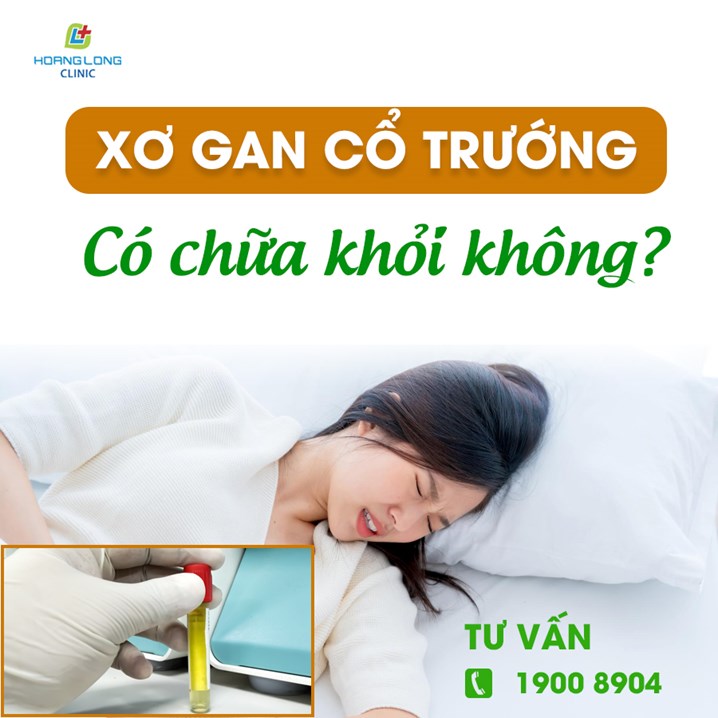 Xơ gan cổ trướng có chữa được không?