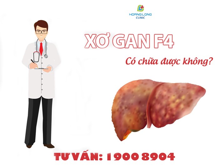 Xơ gan F4 có chữa được không?