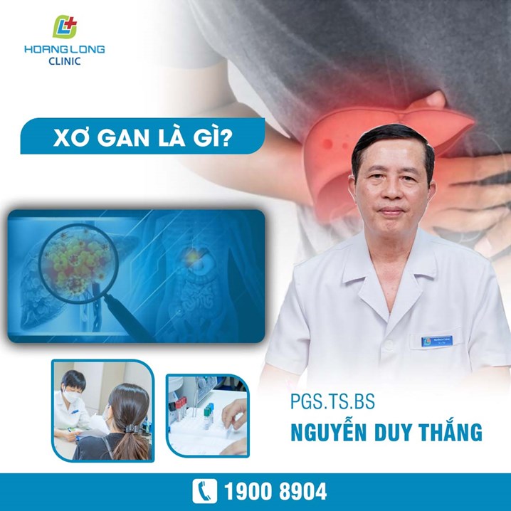 Xơ gan là gì? Chia sẻ từ chuyên gia PGS.TS.BS Nguyễn Duy Thắng