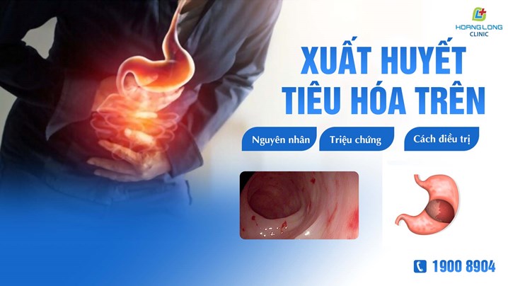 Tổng quan về bệnh xuất huyết tiêu hóa trên