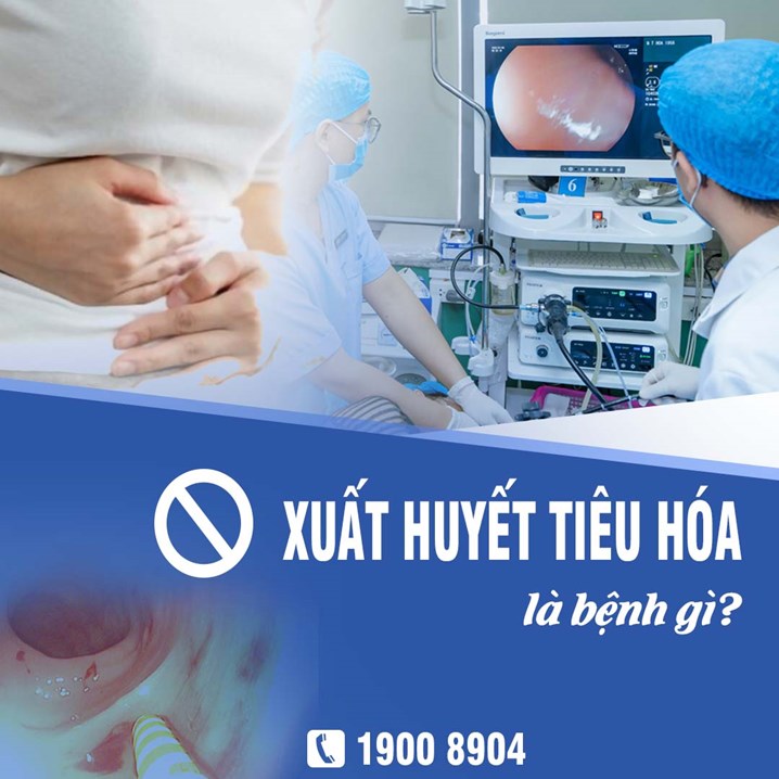 Xuất huyết tiêu hóa là bệnh gì?