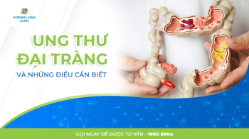 UNG THƯ ĐẠI TRÀNG VÀ NHỮNG ĐIỀU CẦN BIẾT
