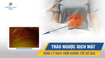 Trào ngược dịch mật – bệnh lý nguy hiểm không thể bỏ qua