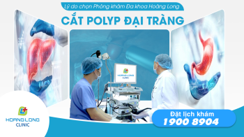Why should you choose Hoang Long clinics to remove colon polyps?