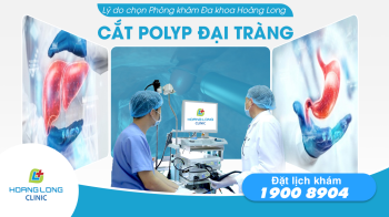 Lý do chọn Phòng khám Đa khoa Hoàng Long để cắt polyp đại tràng