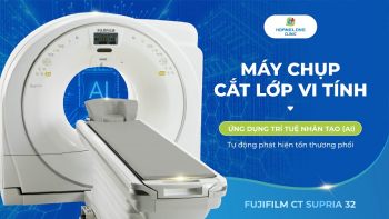 MÁY CHỤP CẮT LỚP VI TÍNH ỨNG DỤNG TRÍ TUỆ NHÂN TẠO (AI) - TỰ ĐỘNG PHÁT HIỆN TỔN THƯƠNG PHỔI