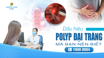 Dấu hiệu của bệnh Polyp đại tràng bạn nên biết