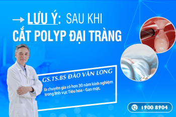 Lưu ý sau khi cắt polyp đại tràng