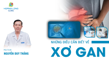 Xơ gan