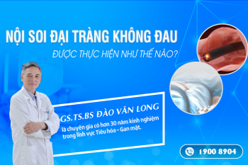 Nội soi đại tràng không đau được thực hiện như thế nào?