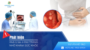 Phát hiện khối u lớn ở đại tràng nhờ khám sức khỏe