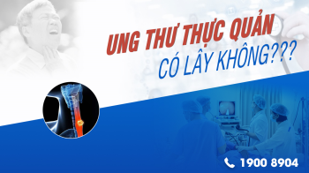 Ung thư thực quản có lây không?