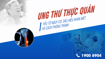 Ung thư thực quản: Yếu tố nguy cơ, dấu hiệu nhận biết và cách phòng tránh