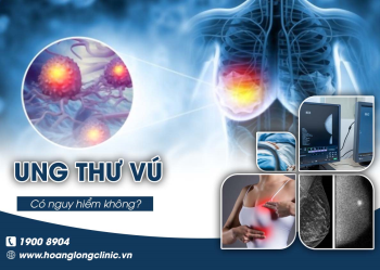 Ung thư vú nguy hiểm như thế nào và làm gì để phòng tránh ung thư vú?