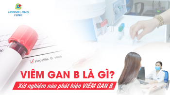 Viêm gan B là gì? Xét nghiệm nào phát hiện Viêm gan B?