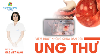 Viêm ruột không chữa trị dễ dẫn tới ung thư