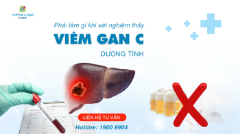 Phải làm gì khi xét nghiệm thấy viêm gan C dương tính?