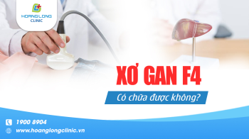 Xơ gan F4 có chữa được không?