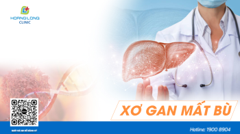 Xơ gan mất bù