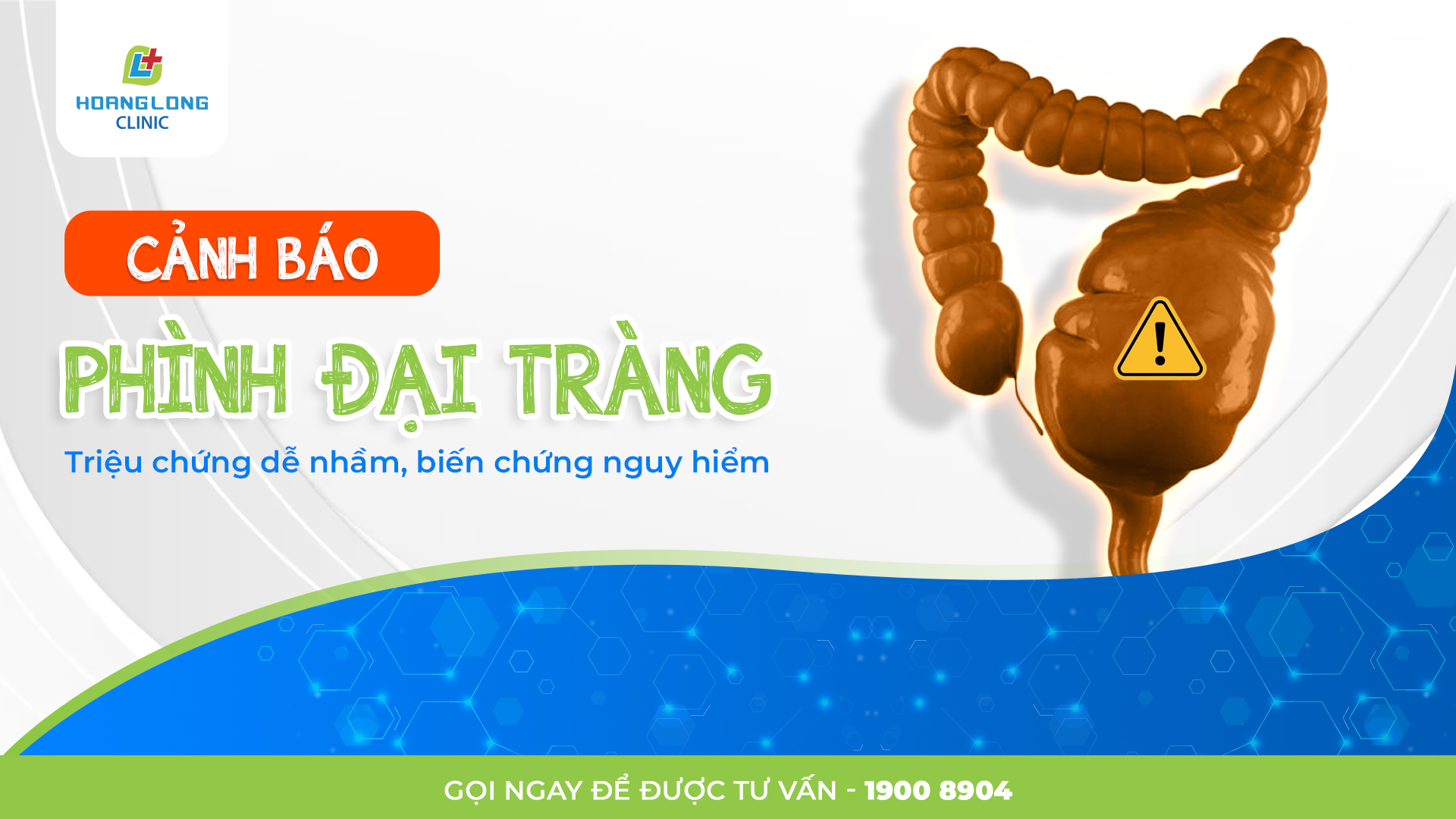 Cảnh báo phình đại tràng: Triệu chứng, biến chứng và cách điều trị