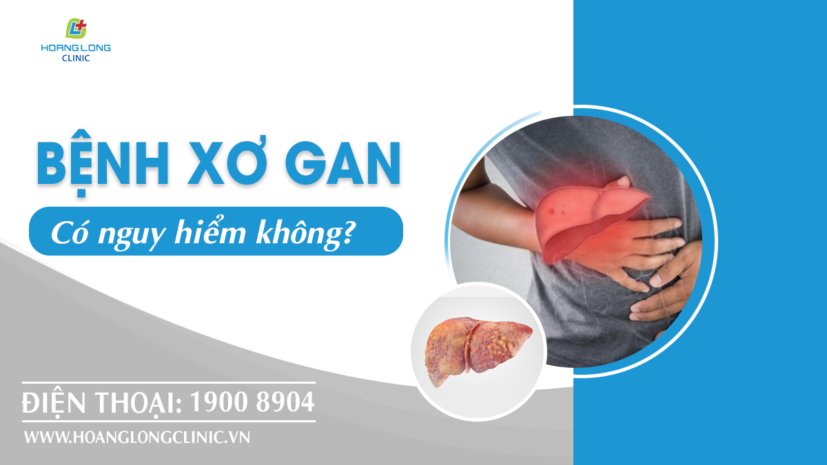 Bệnh xơ gan có chữa khỏi được không?