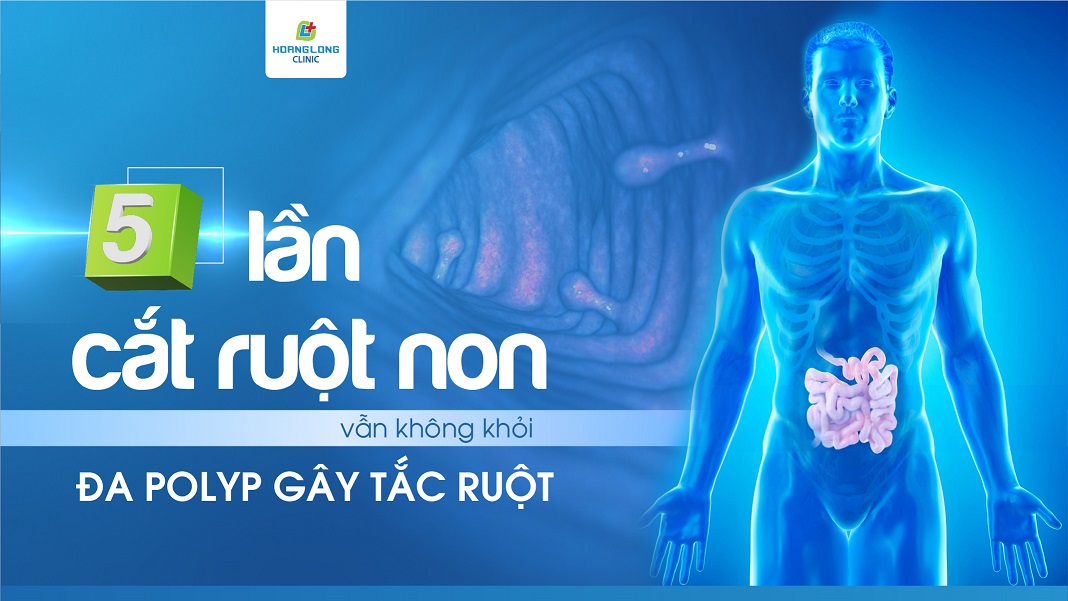 https://www.hoanglongclinic.vn