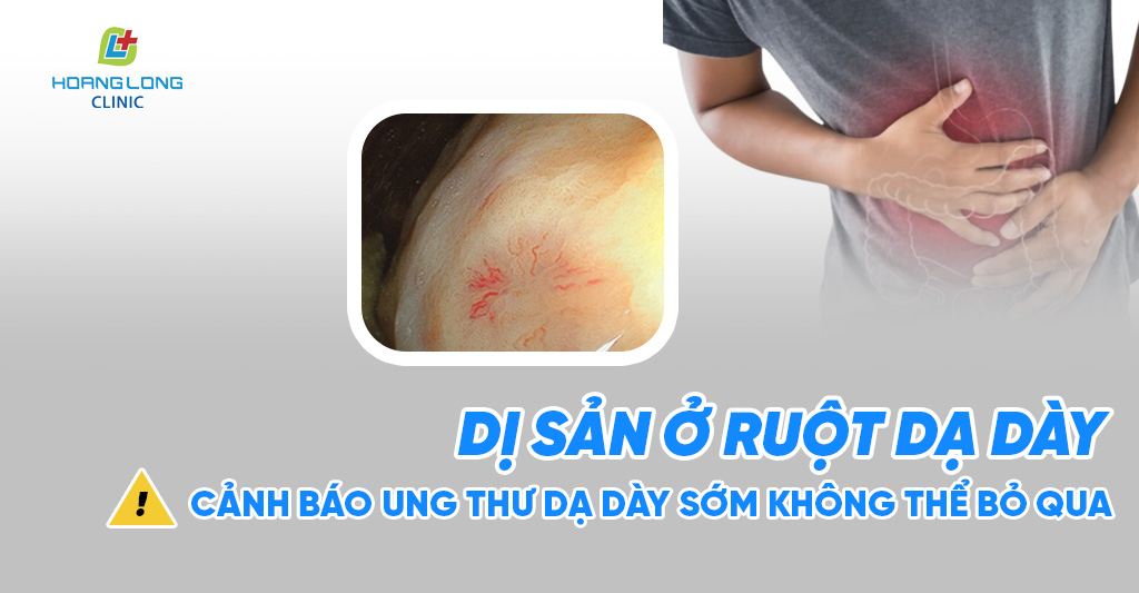 Dị sản ruột ở dạ dày – cảnh báo ung thư dạ dày sớm không thể bỏ qua