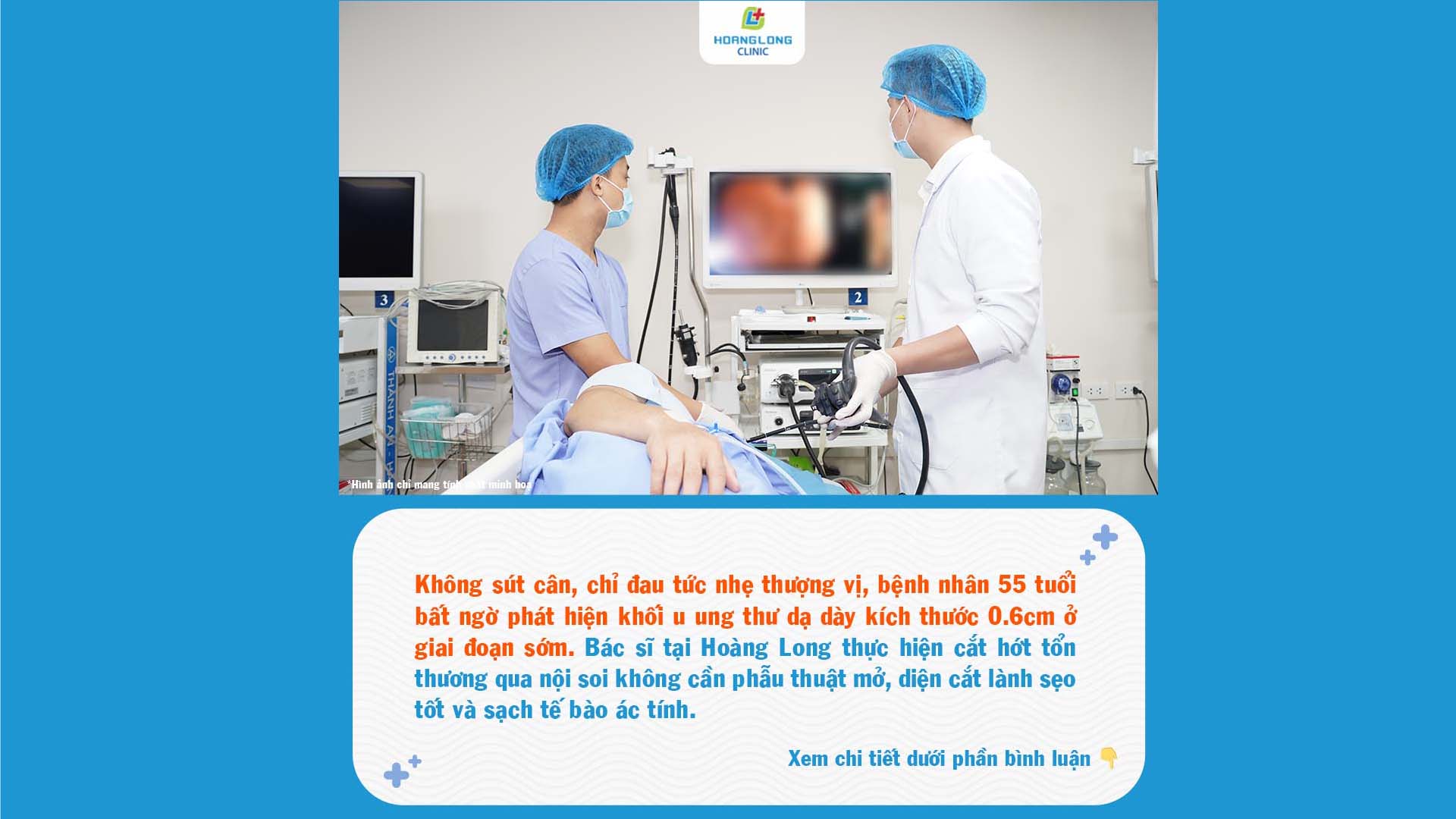Ăn uống bình thường, không sụt cân - người bệnh đi khám bất ngờ phát hiện ung thư dạ dày giai đoạn sớm