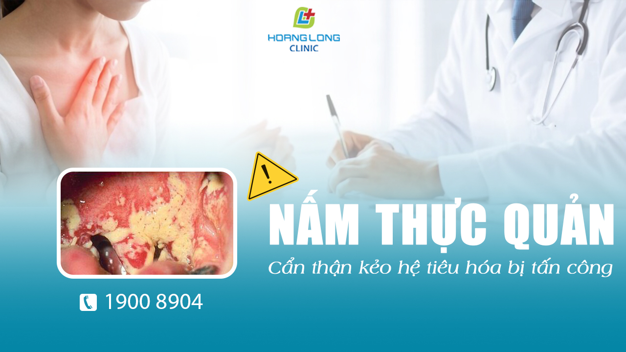 Nấm thực quản – cẩn thận kẻo hệ tiêu hóa bị tấn công