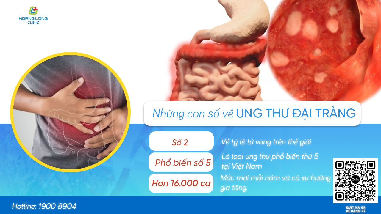 Ung thư đại trực tràng