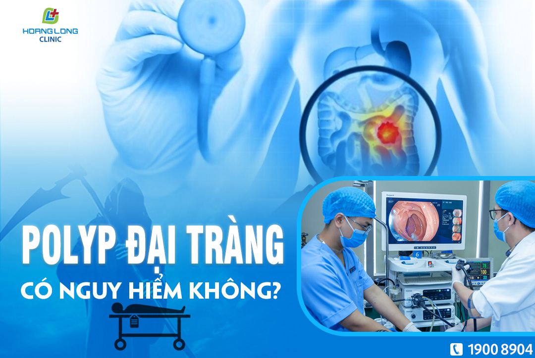 Polyp đại tràng có nguy hiểm không?