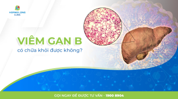 VIÊM GAN B CÓ CHỮA KHỎI ĐƯỢC KHÔNG?