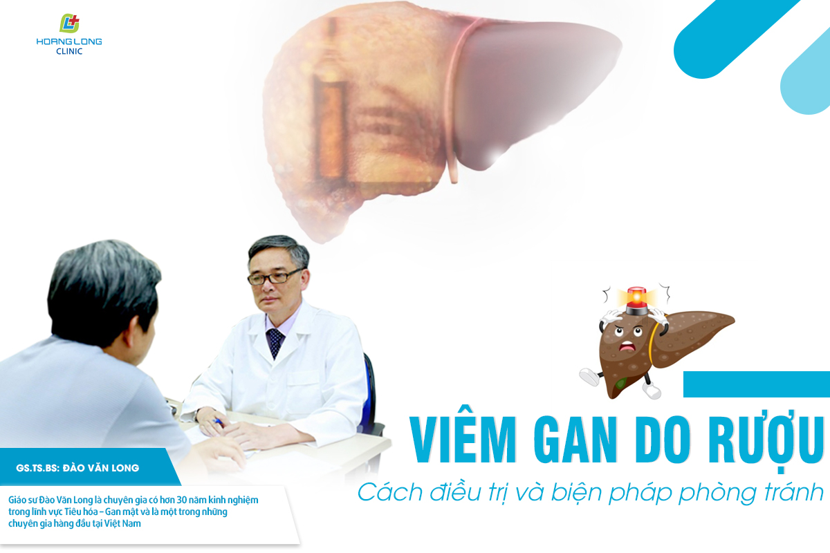 Viêm gan do rượu - cách điều trị và biện pháp phòng tránh