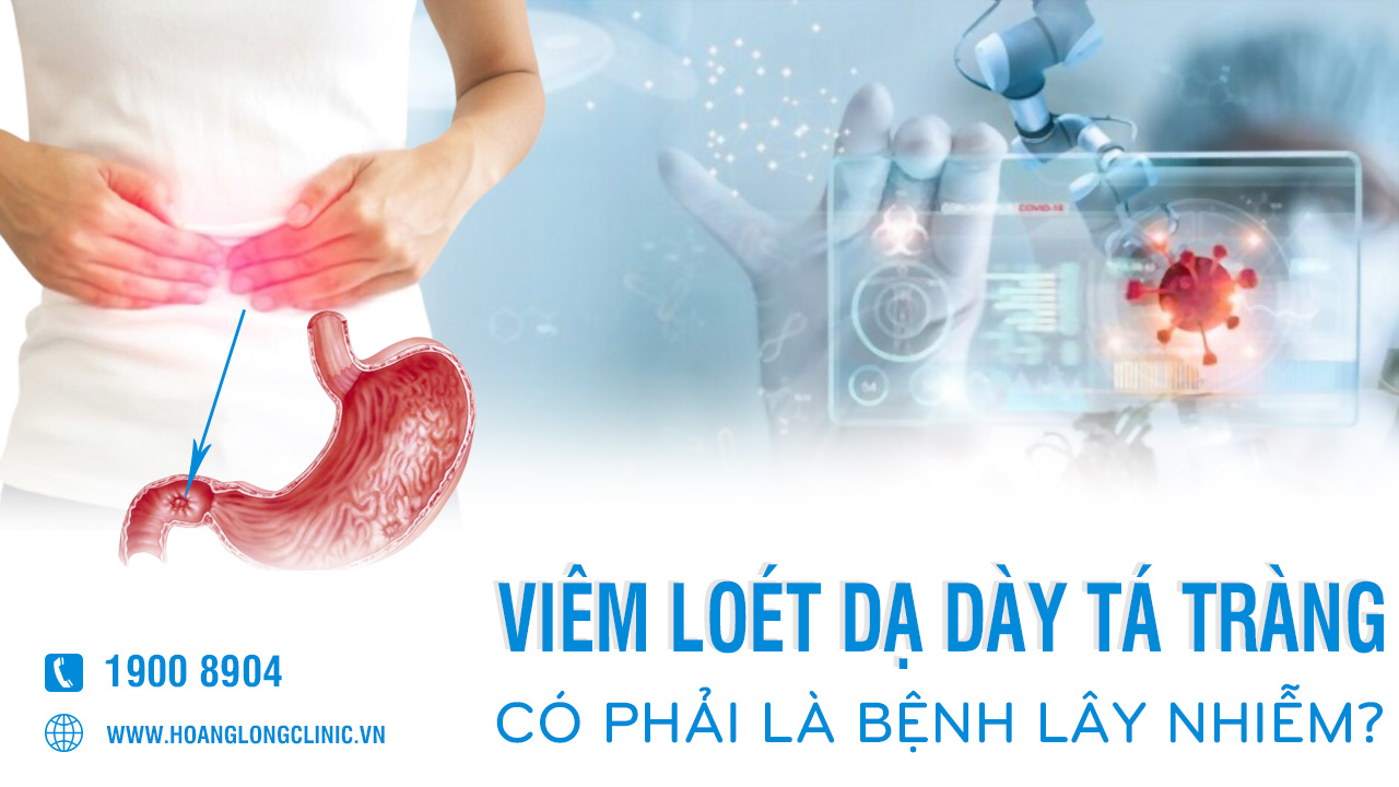 Viêm loét dạ dày tá tràng có phải là bệnh lây nhiễm?