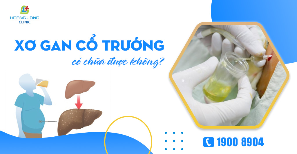 Xơ gan cổ trướng có chữa được không?